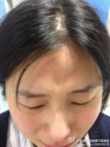 成都一护士凌晨查房遭患者家属殴打打人者被拘(图)