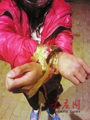 男子不堪前妻待他人温柔绑架威胁一起吞安眠药