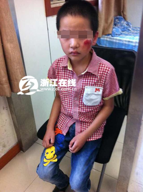 杭州8岁男孩医院门口被人抢走摔下当场骨折(图)