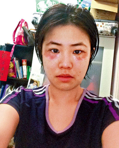 ����ٸ���������Ĥ���������ײұ䡰�����ޡ�