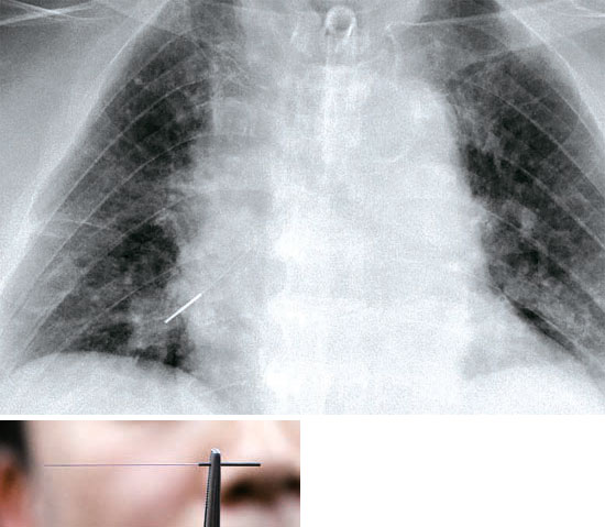 ��ǰ��ͳ�β�ȡ��6.5���׳���ԭ��δ����ͼ��