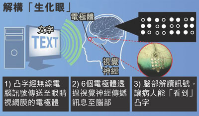 盲人装上“生化眼”可数秒内看清凸字(图)