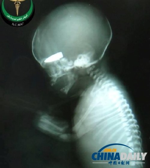 ��ý��������и�����Ϸ�������̥��������