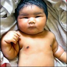 印度妇女产下11.8斤女婴系该国最重新生儿(图)