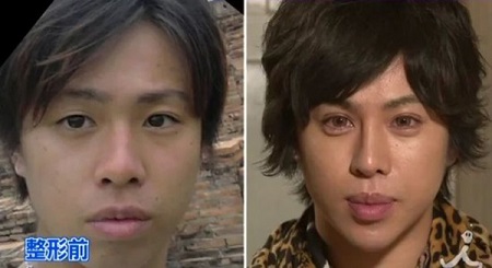 男子受富婆资助耗资15万美元整容成“大卫”(图)