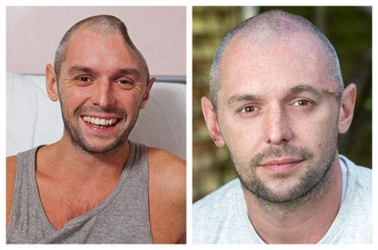 ����ʧ�㡰ˤ�⡱���ͷ�Ѱ����ָܻ���ò��ͼ��