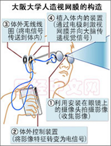 日本将临床应用人造视网膜可助失明者恢复视力