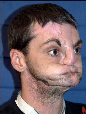 Ӣ��һ����������ǹ�¹ʻ��ݽ�������������