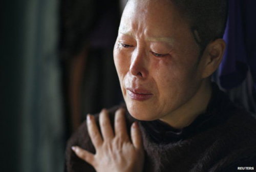 外媒:韩整容广告铺天盖地中国上万人赴韩整容