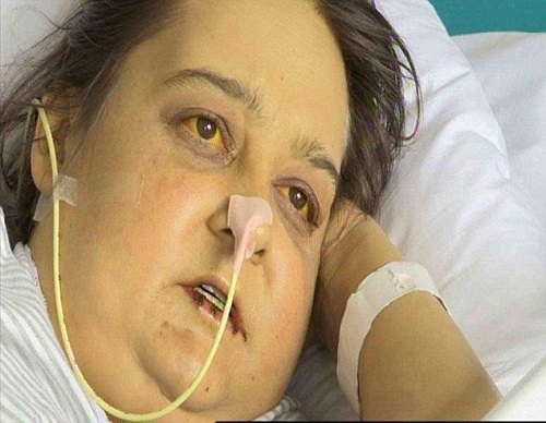 Ů�����25���÷��ؼӵ��緹��˥������ʾ��