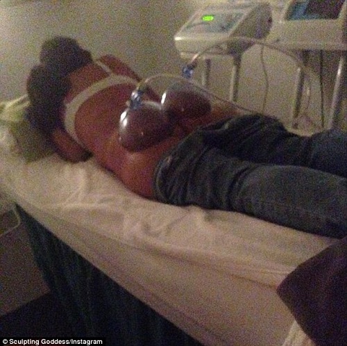 美容院推出“真空丰臀术”用大吸盘吸臀部(图)