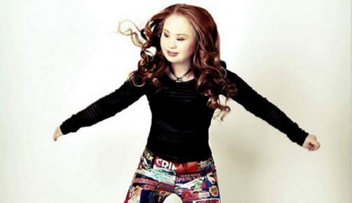 励志澳大利亚一患唐氏综合征女孩圆模特梦