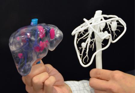 日本研发3D打印肝脏模型法血管等清晰可见(图)