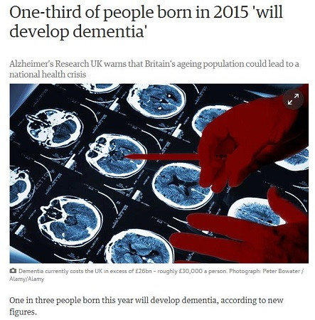 研究:2015年出生的英国人中三分之一将患痴呆症