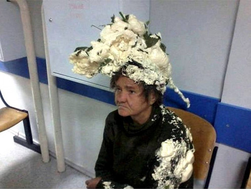 女子误将工业发泡剂当摩丝头顶“菜花”就医(图)