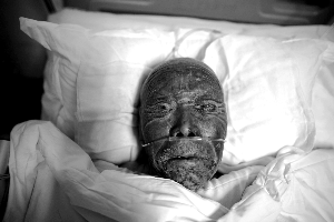 东海拆迁自焚家属获赔90万 死者今火化伤者病重