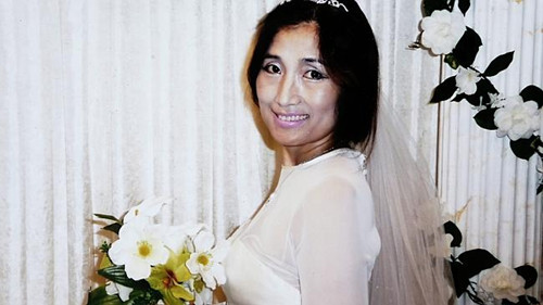 ����һ�����������ӱ�����թ�ɷ�Ʋ���Ѫ���޹�