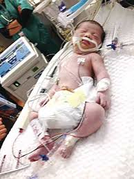 纽约被撞身亡华裔孕妇遗婴逐渐适应自主呼吸(图)