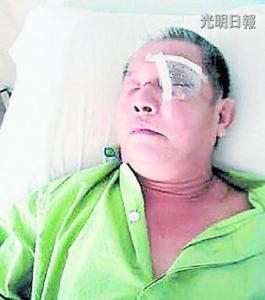 大马60岁独眼华商左眼又被打瞎留下遗书跳楼自杀