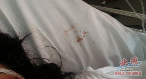 巴塞罗那华人妇女遭劫伤势严重治安再遭侨界吐槽