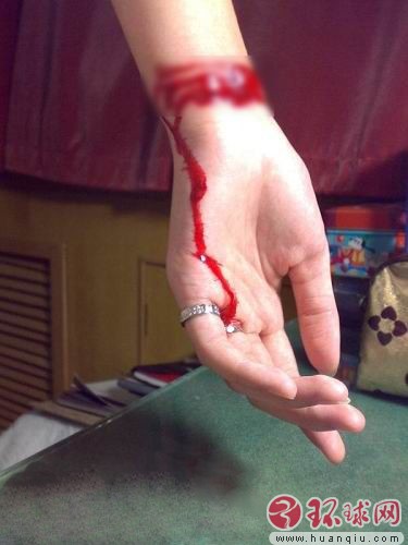 【点击查看其它图片】90后艺校女生网上秀割腕自残照片近日,网上出现