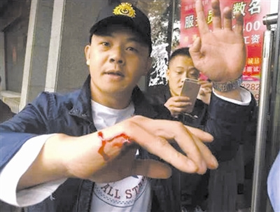 退伍老兵徒手夺枪救人子弹穿透手掌后穿玻璃(图)