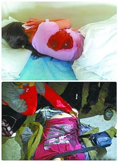 华山被捅游客质疑嫌犯顶包称未争吵即遭群殴