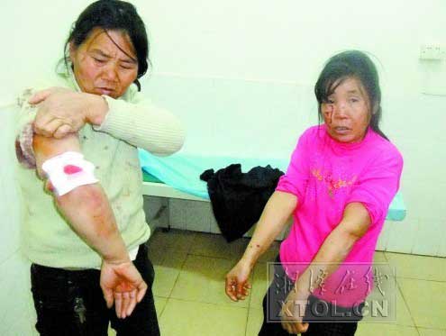 百斤重藏獒一连咬伤7人民警开枪将其击毙