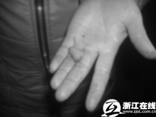 女子凌晨独行遭色狼强吻生生咬下对方舌尖(图)