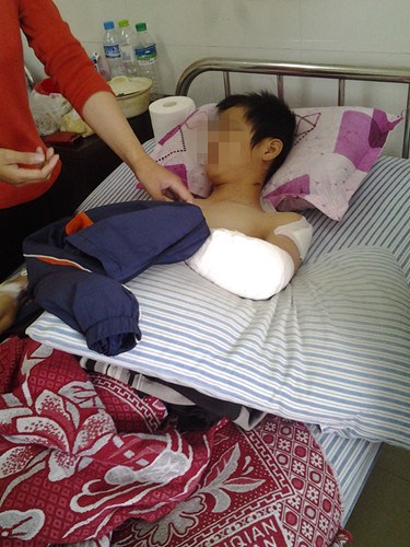大人积怨小孩遭殃六旬老汉为泄愤刀砍堂弟孙子