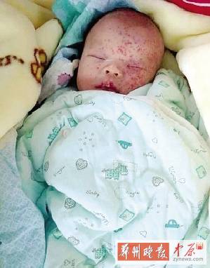未满月女婴卫生院门口遭遗弃脸上爬满蚂蚁(图)