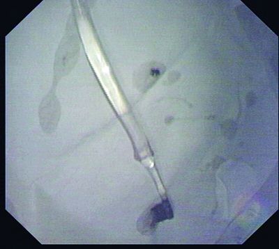 Ů��ˢ���ӵ绰��ˢ����θ�ﾭʳ��ȡ��