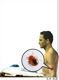 京沪高铁现吸血臭虫上海铁路局增加灭虫频次