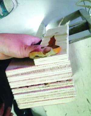 女子钉木架出意外钉子跑偏戳穿右手拇指(图)