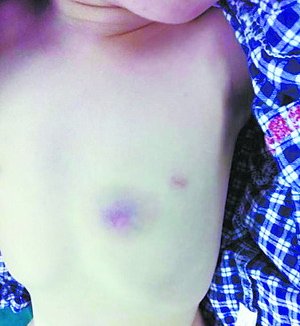 ��ͯ����ȡ��5���׷������˼���������ࣨͼ��