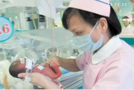 孕期25周早产男婴体重800克仅成人巴掌大小(图)