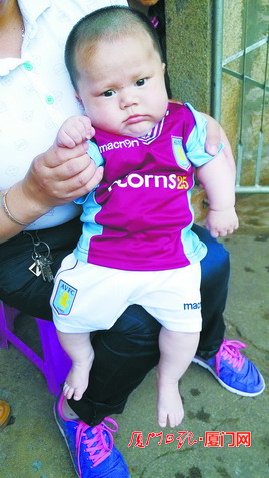 厦门“奇迹宝宝”脑积水愈发严重将赴京做手术