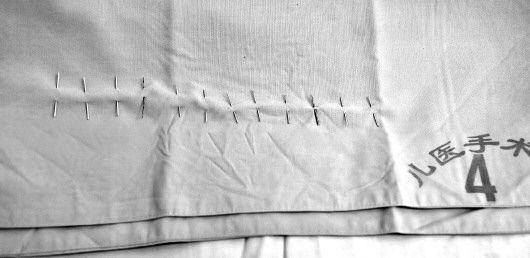 ɽ��������ŮӤ12����ȫȡ��һ�ܺ���ܳ�Ժ