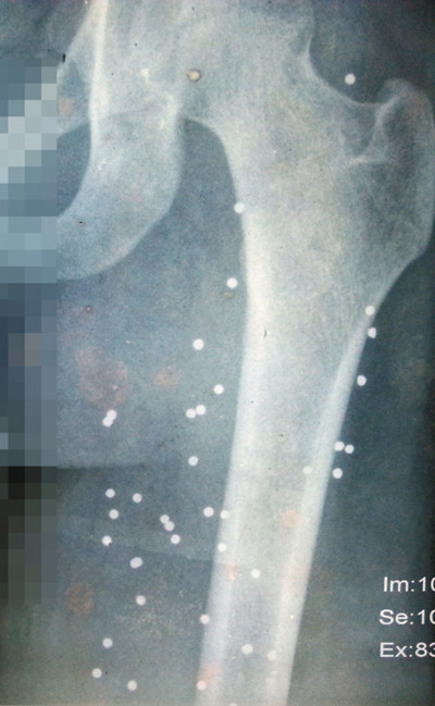 广东致1死5伤枪击案6年真相不明涉案人员悉数翻供