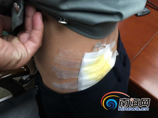 海口摊贩暴力抗法打伤城管执法人员四人被行政拘留