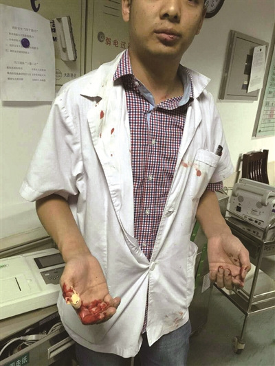 ����һҽ�������߼���Ź�򲢷���ܾ�α�첡��