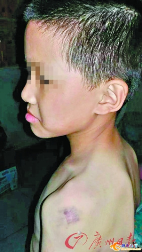 课间玩游戏撞到老师两名小学生遭拳打脚踢(图)