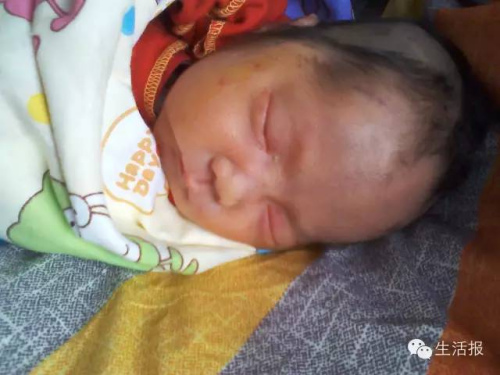 哈尔滨:患脑病新生女婴被弃公墓身上爬满蚂蚁