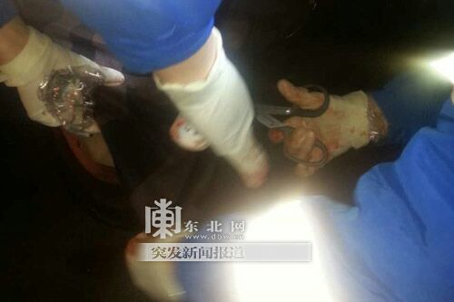 姐弟俩遛弯回家途中遇袭弟弟被刀刺伤致肾摘除