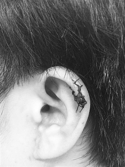 女子理发耳朵被剪伤缝8针理发店称仅赔5000元