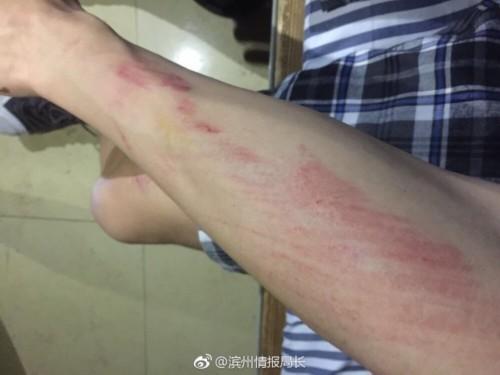 大学生情侣校园内搂抱被查遭围殴涉事学生被处分