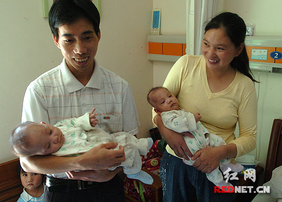 湖南连体姐妹今日出院曾受沙特王子关注组图