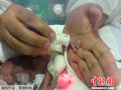 点图查看下一页