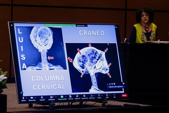 墨西哥展示疑似“外星人”遗骸X光片