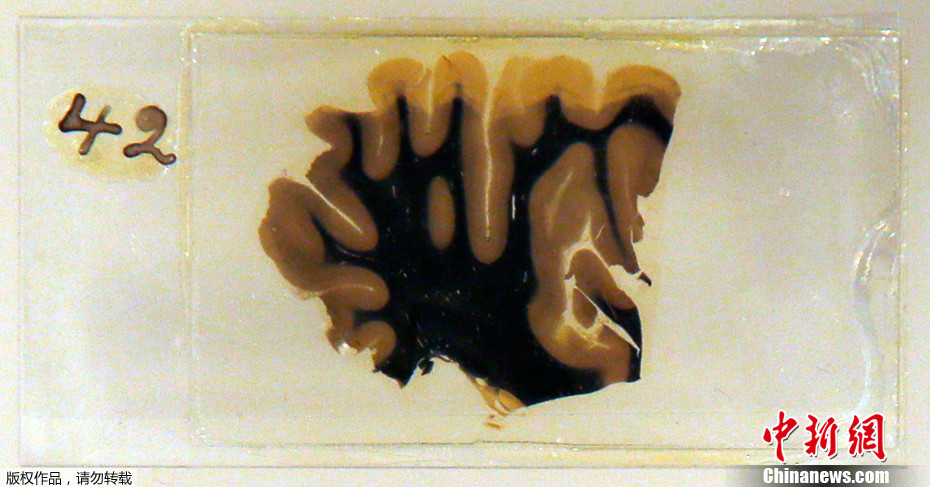 Ӣ���ٰ조���ԡ�չ ����˹̹������Ƭ����